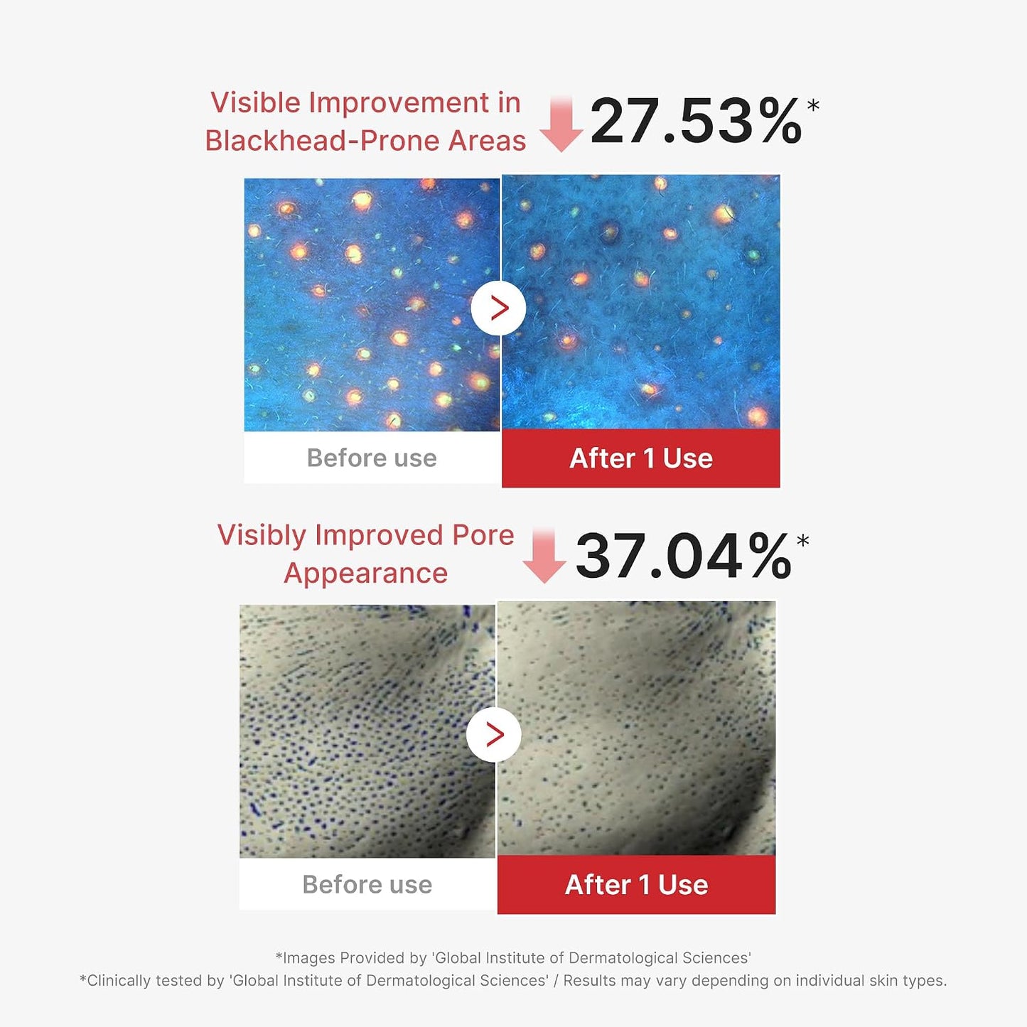 Hypochlorous Acid Peel Mask – Peel-Off Μάσκα Καθαρισμού Πόρων & Σμήγματος με Υποχλωριώδες Οξύ
