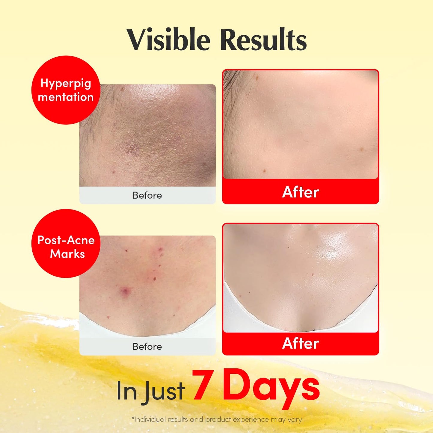 Vitamin Illuminating Cream – Λευκαντική & Ενυδατική Κρέμα Προσώπου για Λάμψη & Ομοιόμορφο Τόνο