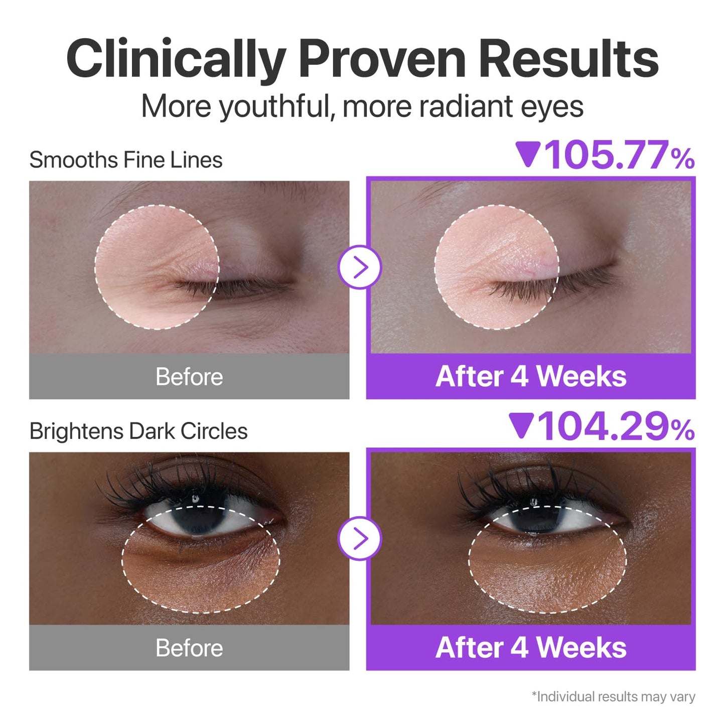 No.9 NAD Retinol Volumetox Eye Cream - Συσφιγκτική Κρέμα Ματιών με NAD+ & Ρετινόλη για Λεία, Ξεκούραστη Όψη