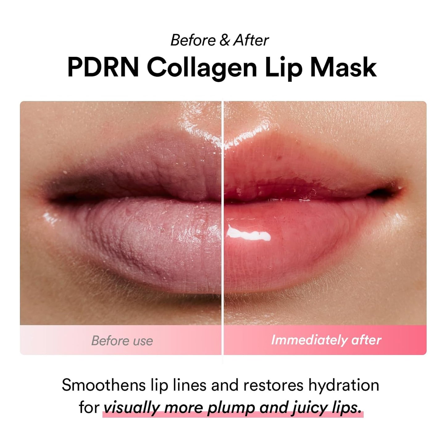 PDRN Collagen Lip Mask Glazed Jelly - Μάσκα Χειλιών με Ενυδάτωση & Σύσφιξη