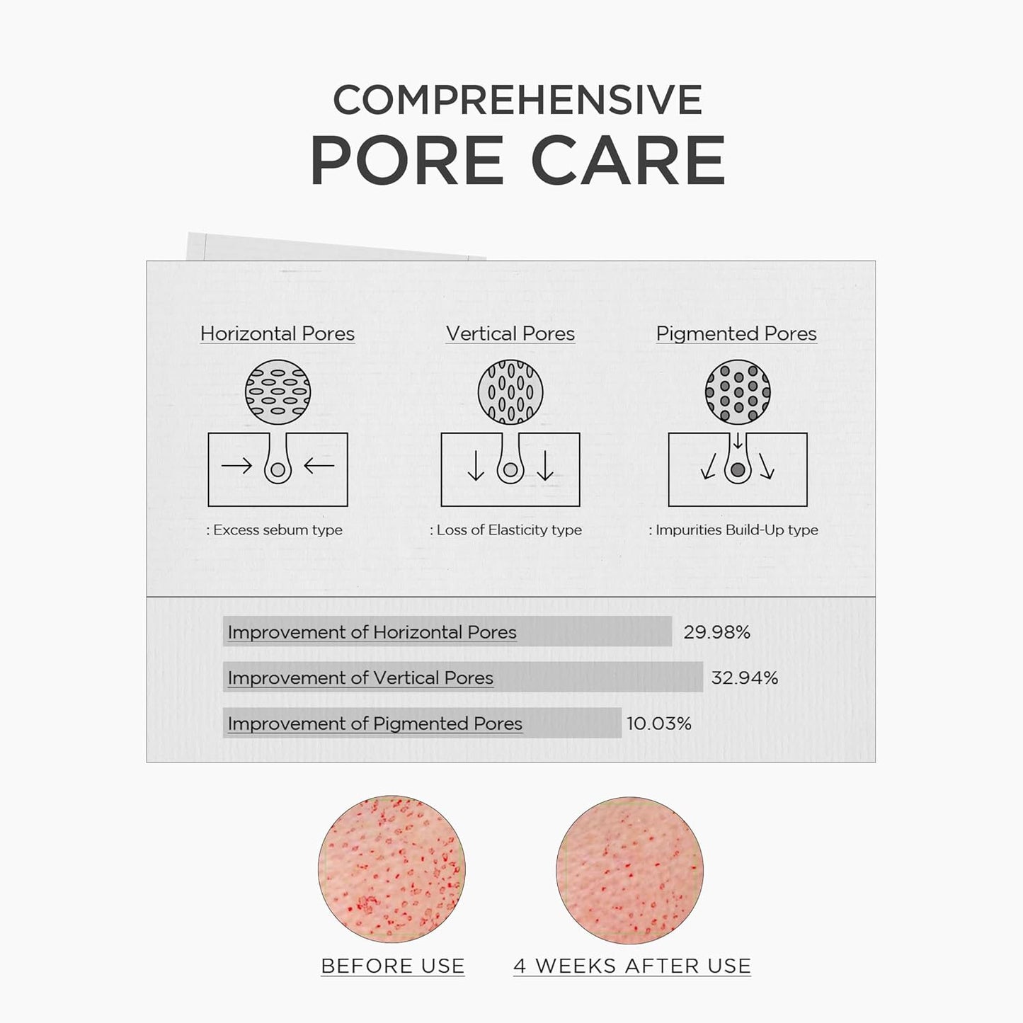 Niacinamide 10 Boosting Shot Ampoule - Ενισχυμένη Αμπούλα Νιασιναμίδης 10% για Πόρους & Λάμψη