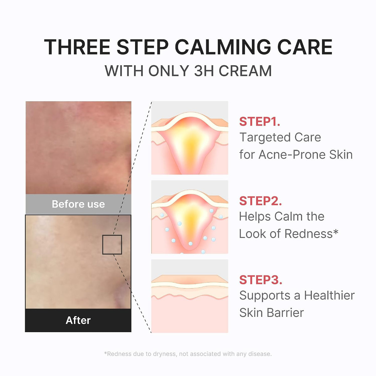 Hypochlorous 3H Relief Cream – Καταπραϋντική Κρέμα Ενυδάτωσης για Ευαίσθητη Επιδερμίδα & Ενίσχυση του Επιδερμικού Φραγμού