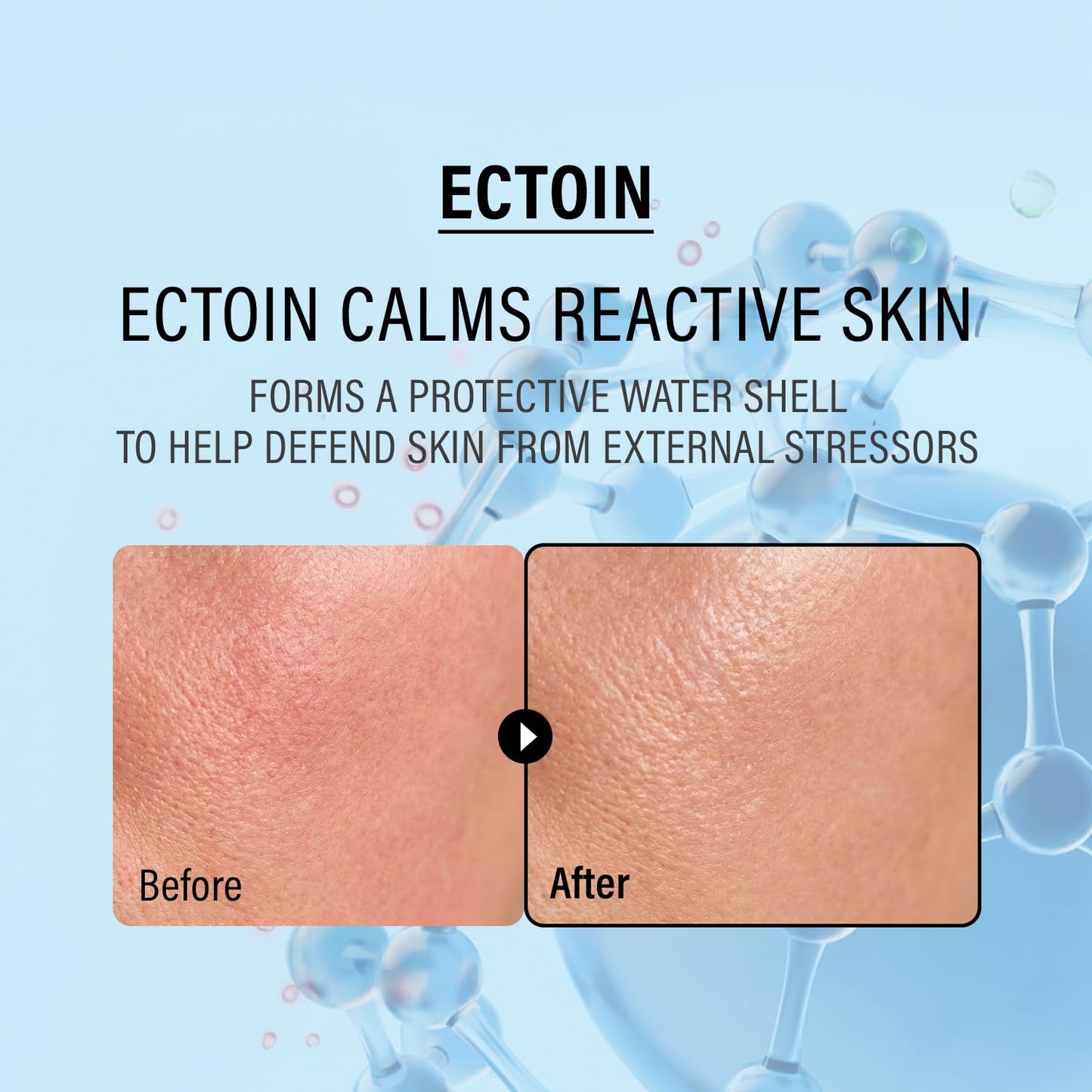 Double Up Cream Ectoin / Panthenol – Καταπραϋντική Κρέμα Ενυδάτωσης & Ενίσχυσης του Επιδερμικού Φραγμού