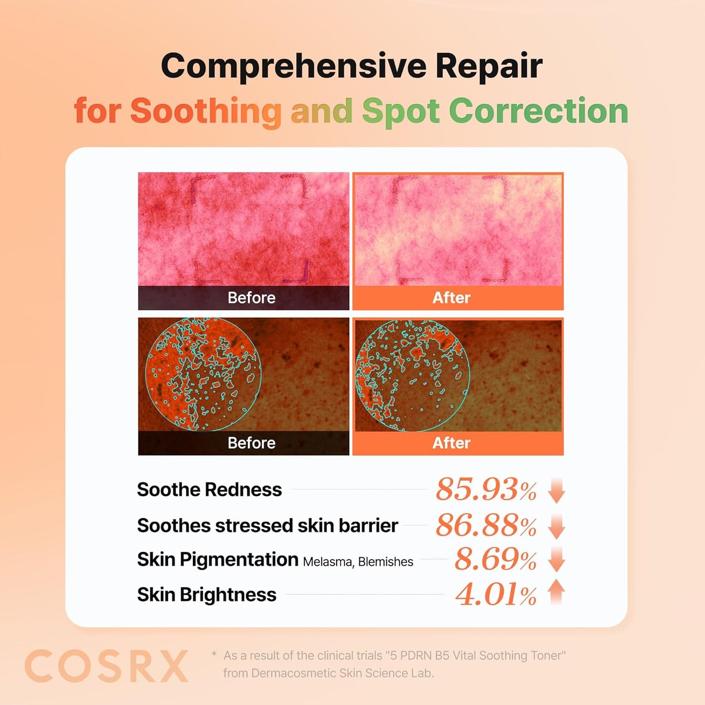 5 PDRN B5 Vital Soothing Toner - Αναζωογονητικό Toner για Λάμψη, Σύσφιξη & Καταπράυνση