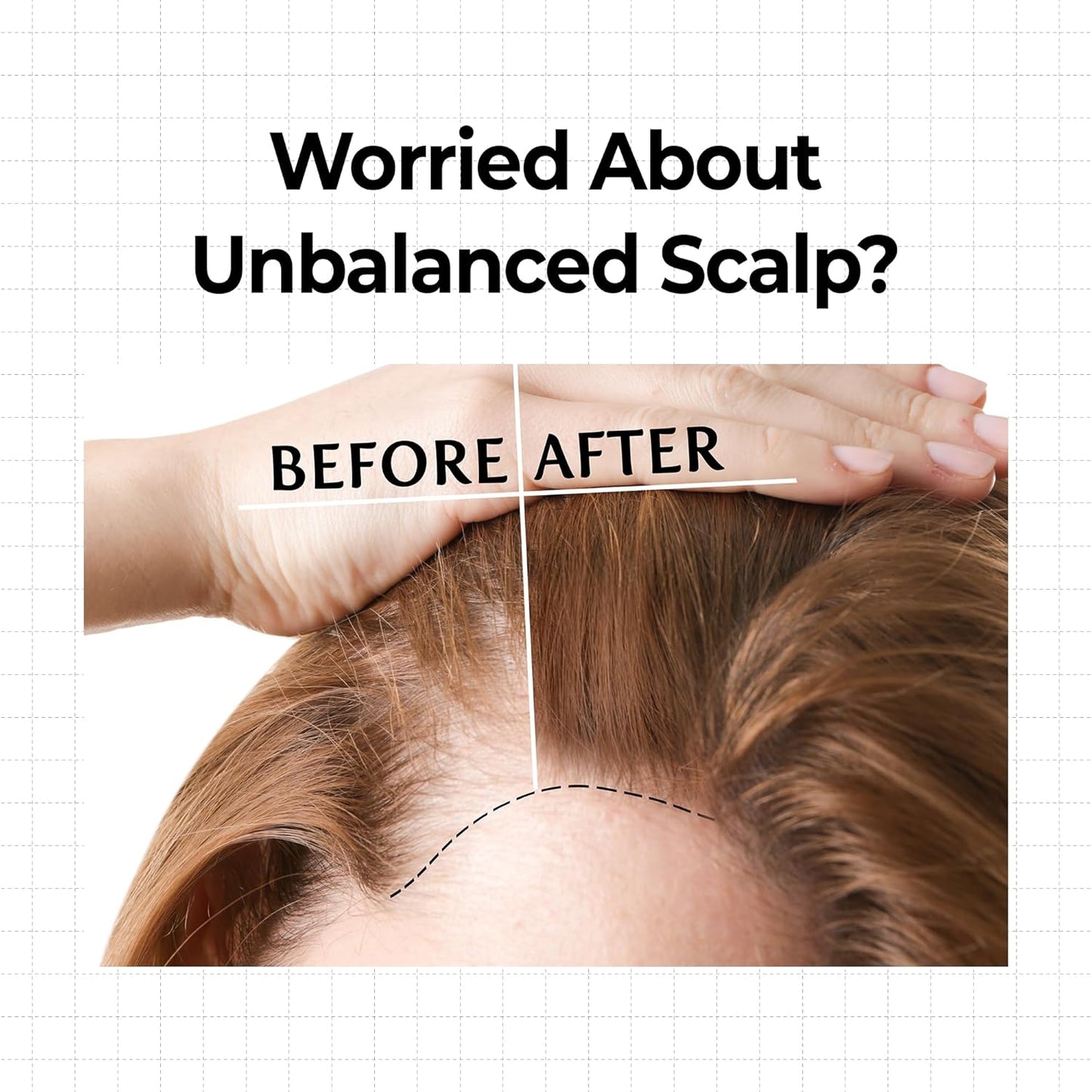 10X Caffeine Strengthening Scalp Serum – Ορός Ενδυνάμωσης Τριχωτού με 10x Καφεΐνη για Πιο Δυνατά & Πυκνά Μαλλιά