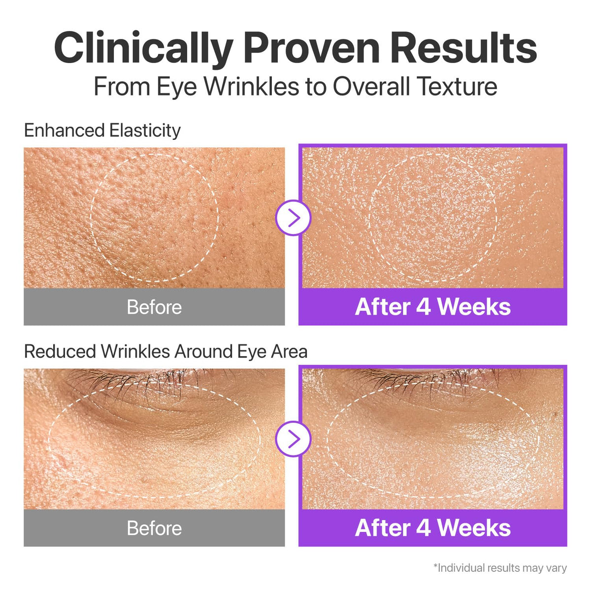 No.9 Nad Bio Lifting-sil Essence - Επαναστατικό essence lifting