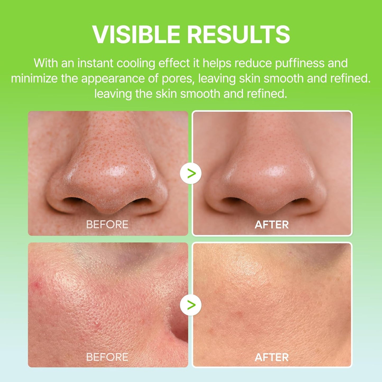 Cactox Pore Relief Multi Balm - Δροσιστικό Balm για Σύσφιξη Πόρων & Μείωση Πρηξίματος