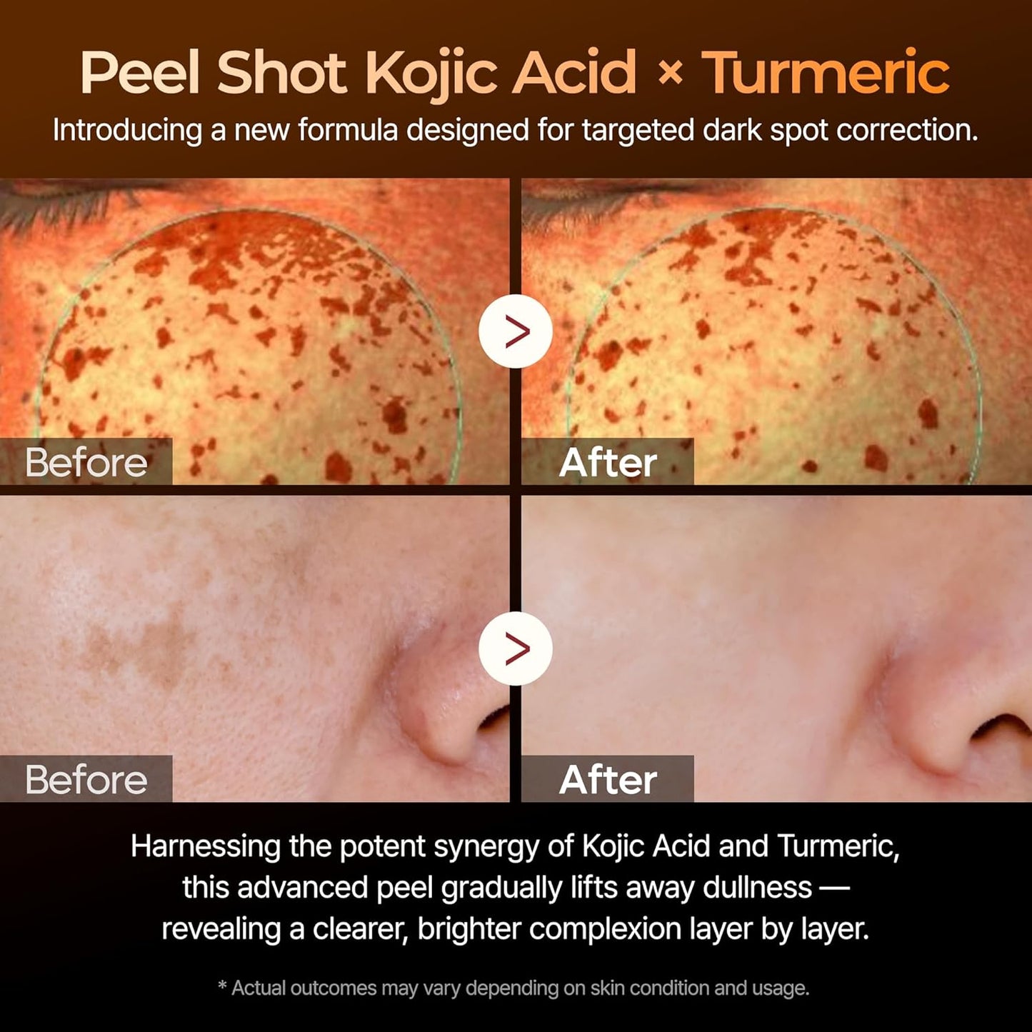 Peel Shot Exfoliating Kojic Acid Turmeric Serum – Απολεπιστικός Ορός Λάμψης με Kojic Acid & Κουρκουμά