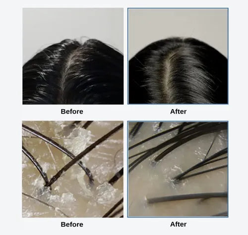 Sea Salt Therapy Scalp Scaler - Απολεπιστικό τριχωτού κεφαλής με Θαλασσινό Αλάτι