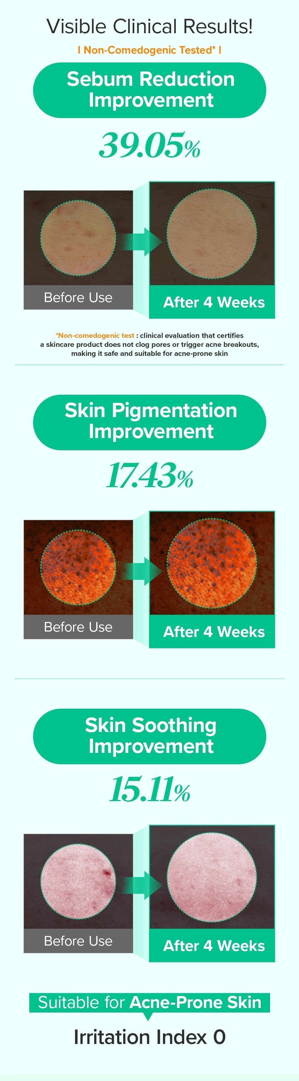 Spicule Azelaic PDRN Spot Cream – Κρέμα για Ατέλειες & Σημάδια Ακμής με Αζελαϊκό Οξύ, Spicules & PDRN