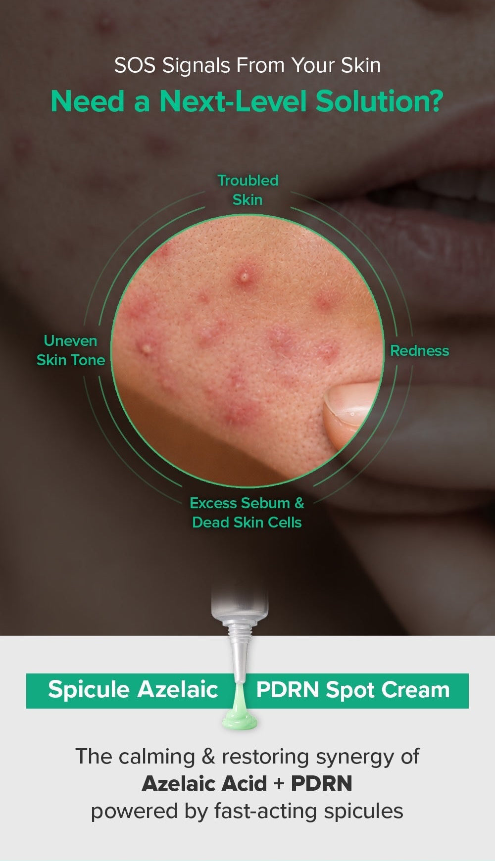 Spicule Azelaic PDRN Spot Cream – Κρέμα για Ατέλειες & Σημάδια Ακμής με Αζελαϊκό Οξύ, Spicules & PDRN