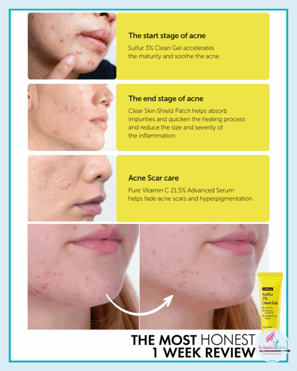 Sulfur 3% Clean Gel - Τζελ με Θείο για Σπυράκια & Λιπαρότητα