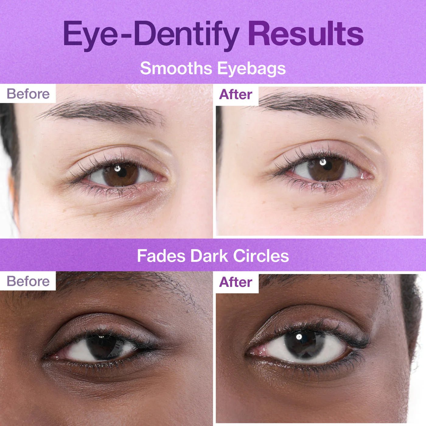 No.9 NAD Collagen Under Eye Patches - Eye Patches με Κολλαγόνο & 50 Πεπτίδια