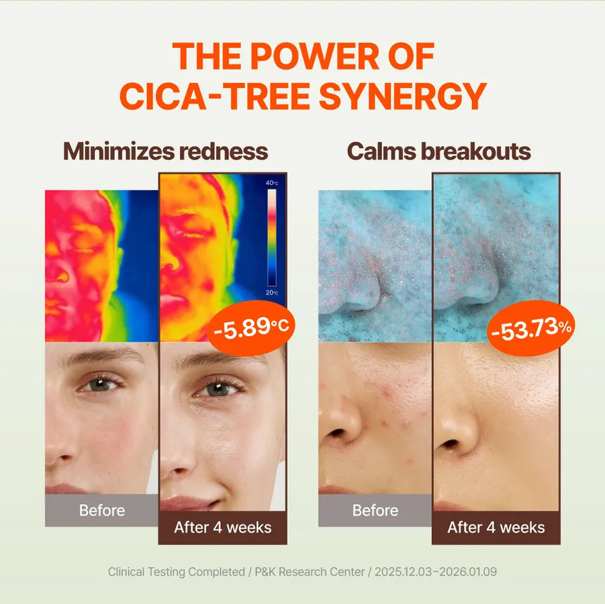 Cica-Tree Soothing Daily Sun Fluid SPF50+ PA++++ – Καταπραϋντικό Αντηλιακό Προσώπου για Ευαίσθητη και Ακνεϊκή Επιδερμίδα